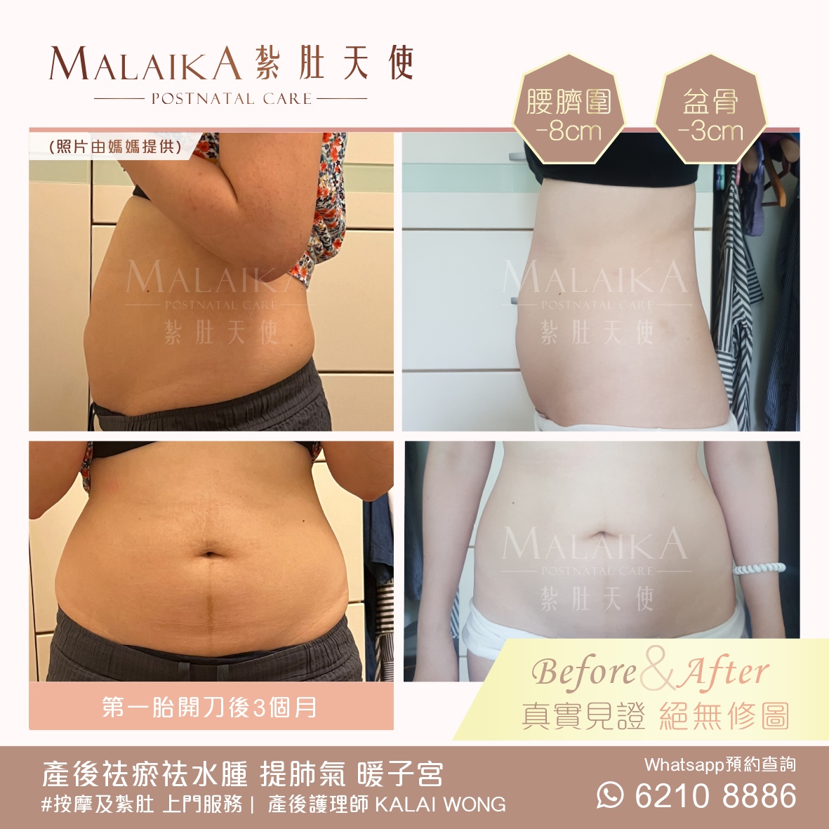 MALAIKA 紮肚天使