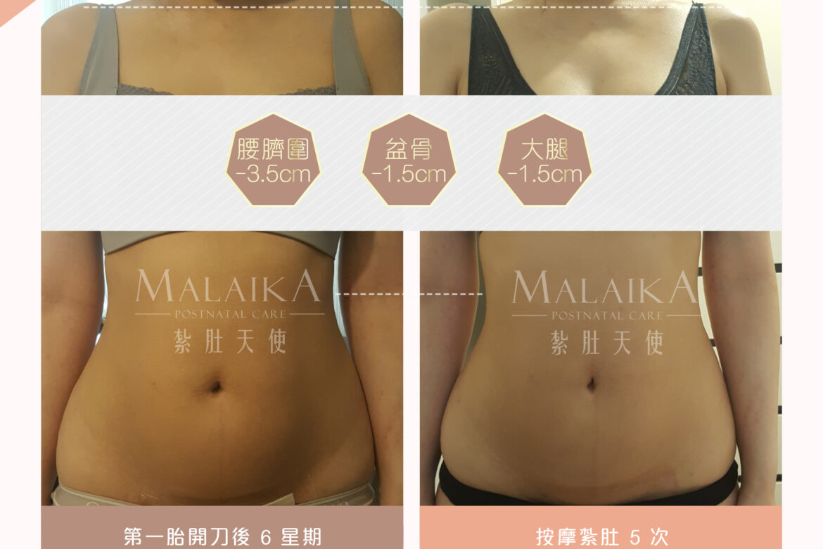 MALAIKA 紮肚天使