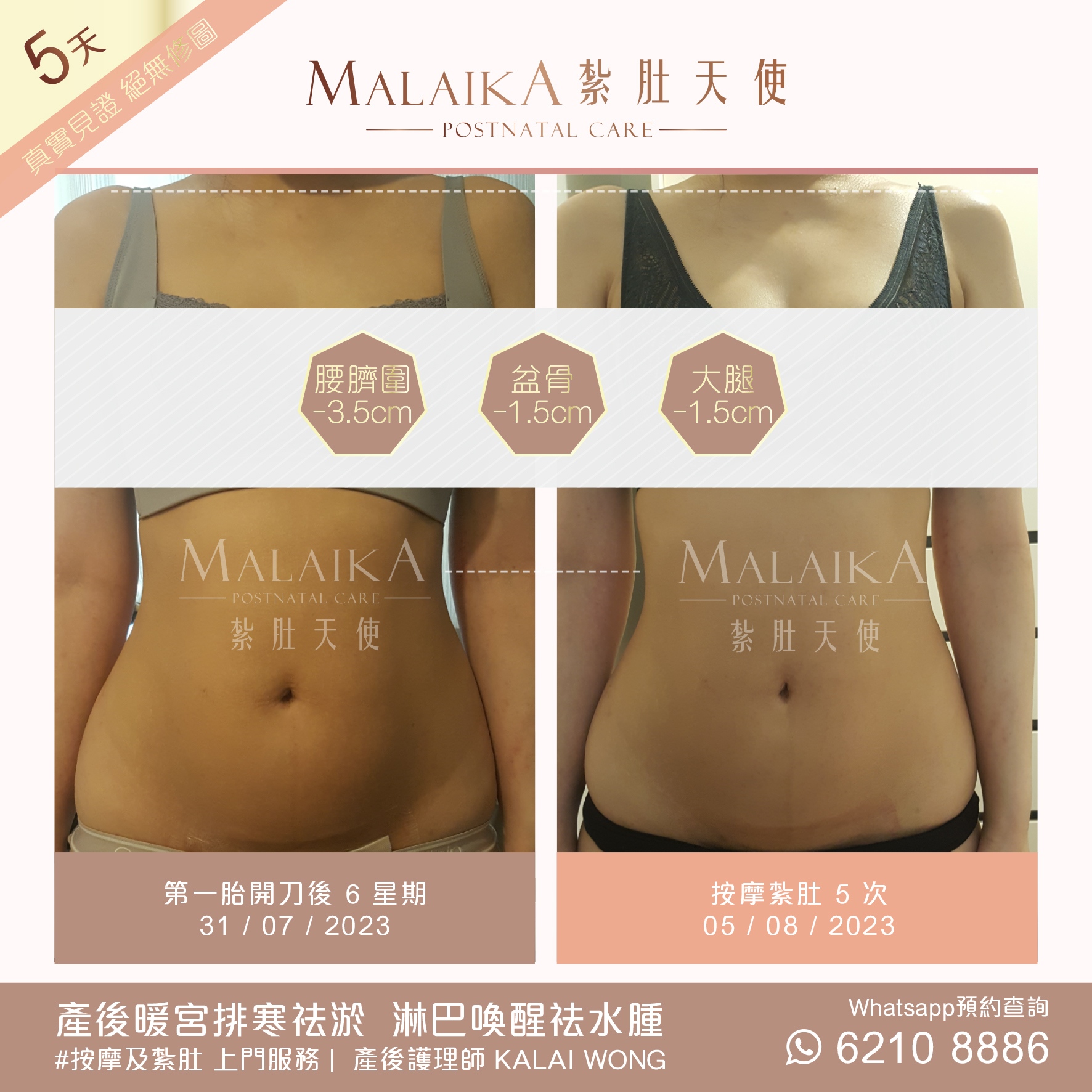 MALAIKA 紮肚天使