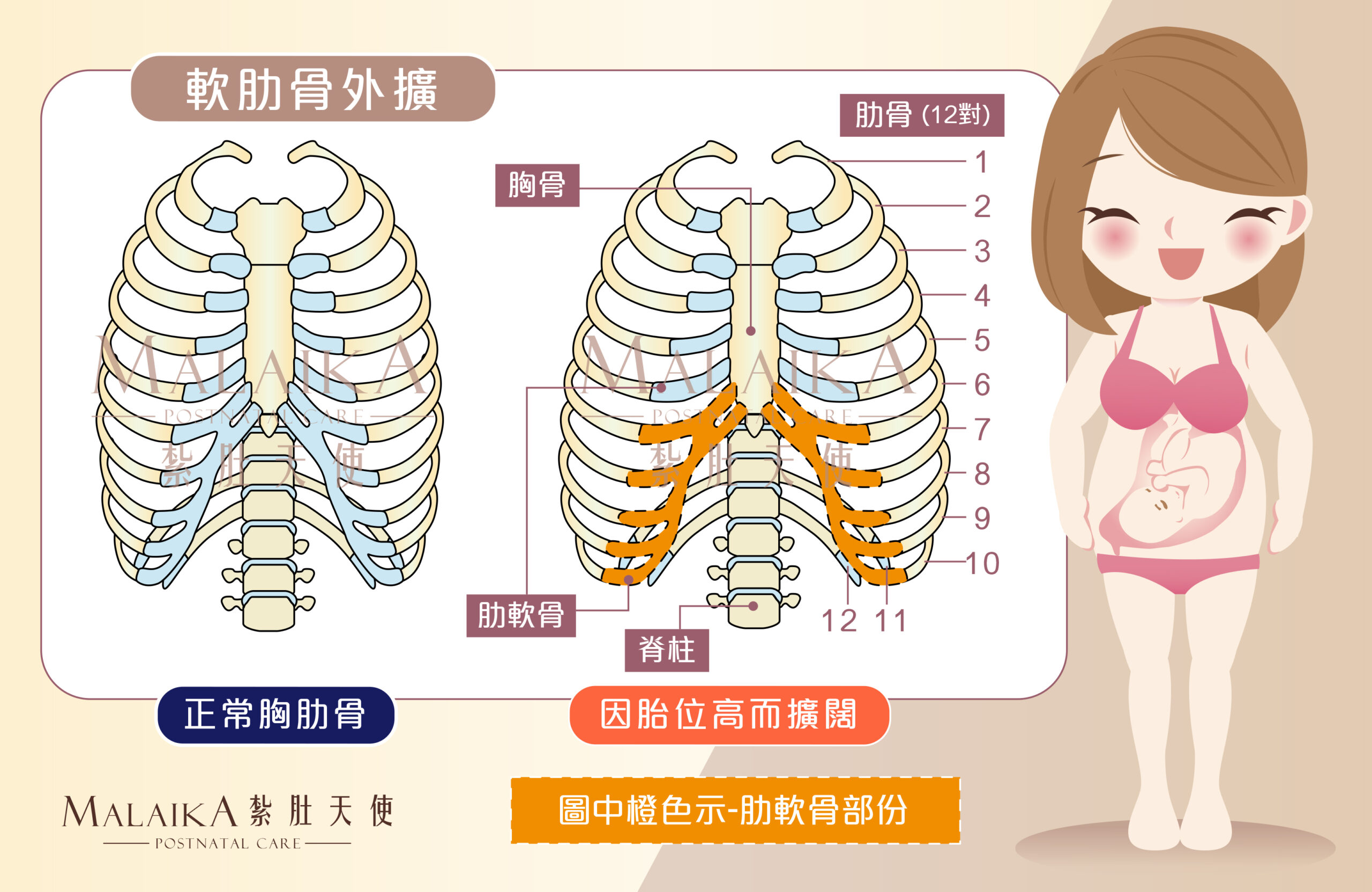 產後腹直肌分離症