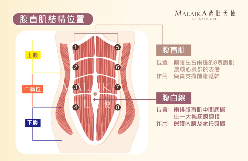 產後腹直肌分離症